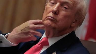 ترامب يظهر مرة أخرى بضمادة على معصمه...