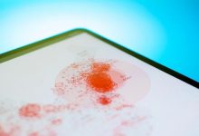 دراسة حديثة تكشف جينات غير متحورة تساهم في نمو السرطان