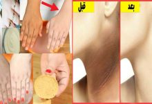 طريقة عمل صابون لبان الذكر لتبييض الإبط والمناطق السوداء بالجسم بوصفة مجربة وغير مكلفة