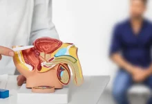 ما الأطعمة المفيدة والضارة لصحة البروستاتا؟