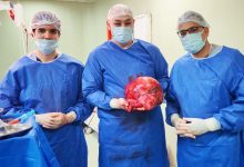 محافظ بني سويف يشيد بطاقم طبي استأصل ورما سرطانيا يزن 15 كيلوجراما لسيدة مسنّة