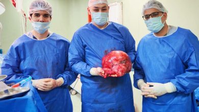 محافظ بني سويف يشيد بطاقم طبي استأصل ورما سرطانيا يزن 15 كيلوجراما لسيدة مسنّة
