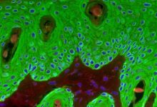 ابتكار مستشعرات حيوية جلدية مضيئة لرصد الالتهابات