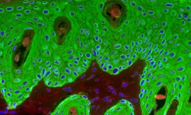 ابتكار مستشعرات حيوية جلدية مضيئة لرصد الالتهابات