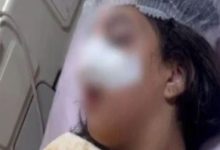 الحبس سنة و6 أشهر وإيداع بدار رعاية لطالبات مدرسة التجمع في اتهامهن بالاعتداء على الطالبة كارما