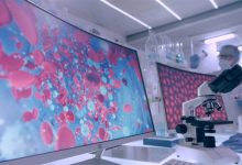 الذكاء الاصطناعي يلتقط خلايا دم خطيرة لا ينتبه لها الأطباء عادة