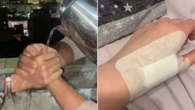 الصحة تُحذر من «ترند المياه المغلية»: سلوكيات غير آمنة تؤدي لمضاعفات خطيرة