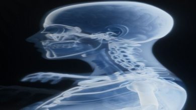 دراسة أميركية تكشف أملاً جديداً لمرضى سرطان الرئة