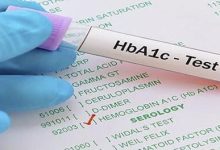 ما يجب أن تعرفه عن اختبار الهيمجلوبين السكرى