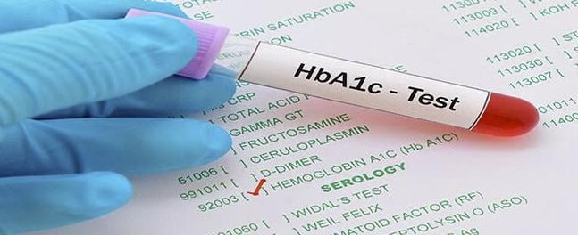 ما يجب أن تعرفه عن اختبار الهيمجلوبين السكرى