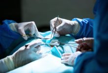 نجاح جراحة معقدة لاستئصال كيس دموي بالطحال بمستشفى الشيخ زايد التخصصي