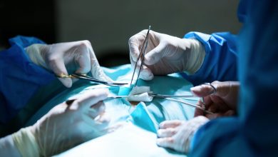 نجاح جراحة معقدة لاستئصال كيس دموي بالطحال بمستشفى الشيخ زايد التخصصي