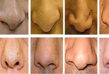 لماذا لا يوجد أنف مثالي يناسب الجميع؟...