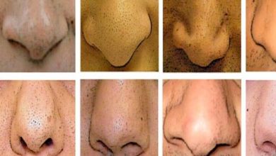 لماذا لا يوجد أنف مثالي يناسب الجميع؟...